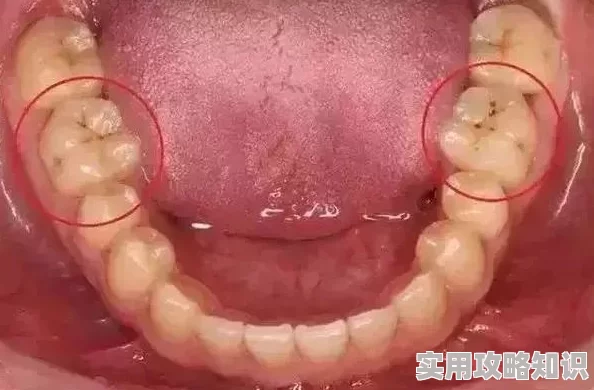 用牙齿轻吸咬小豆挑战网络热门ASMR引发口腔健康争议