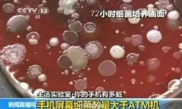 小东西几天不见水又变多怎么回事恐是滋生细菌霉菌产生异味有害健康